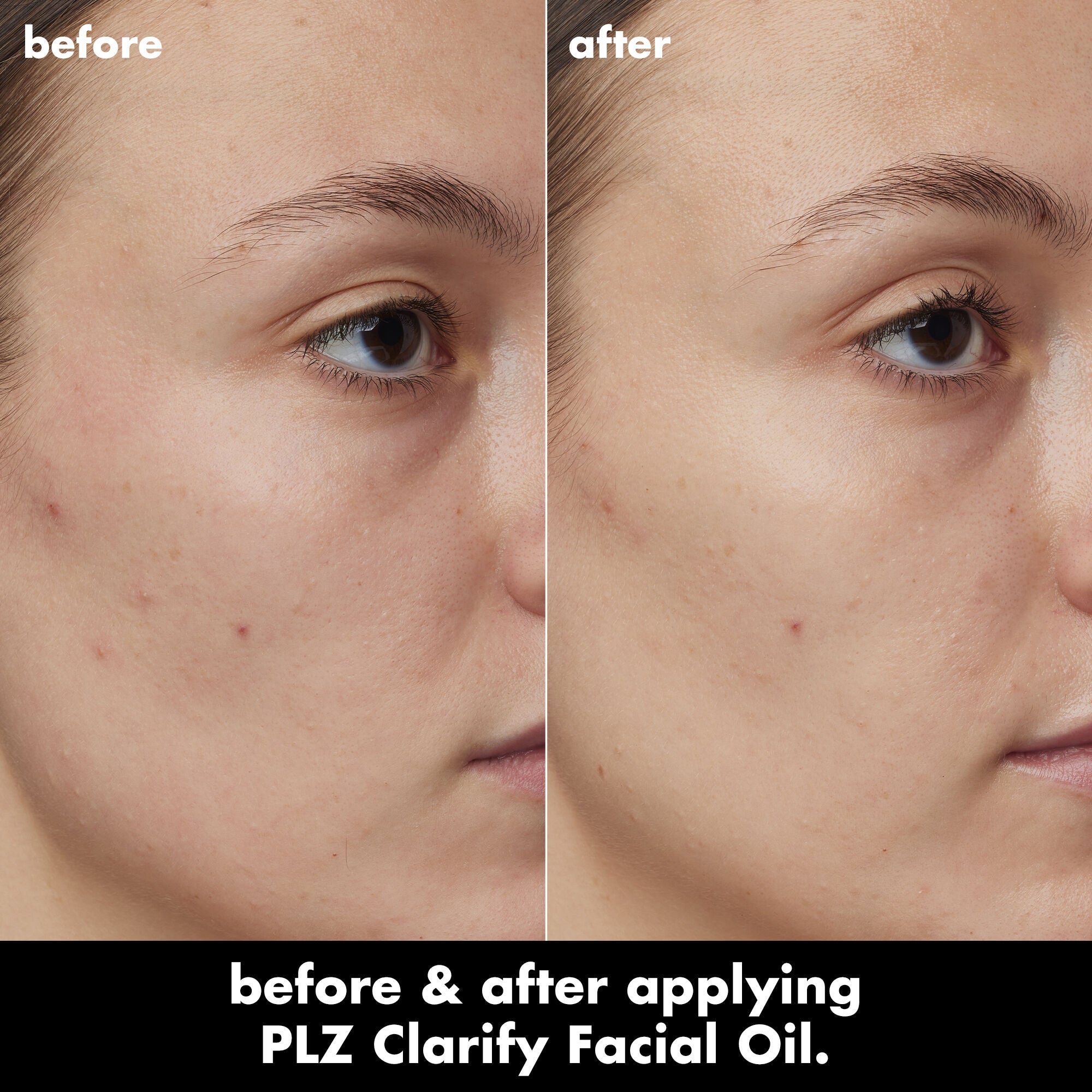 PLZ Clarify Facial Oil